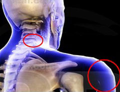 skeletal view of shoulder